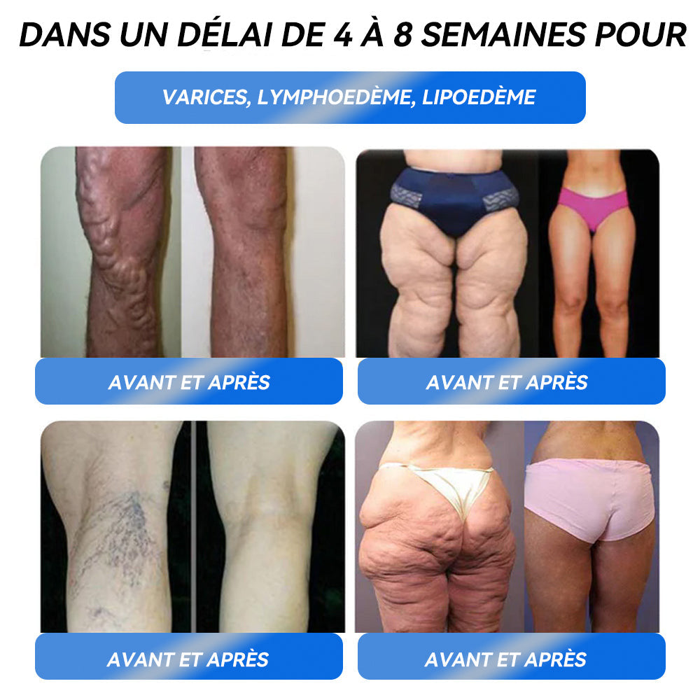 𝐈𝐅𝐌𝐀𝐆𝐈𝐂® 𝐆𝐋𝐏-𝟏 𝐏𝐫𝐨 𝐒𝐨𝐥𝐮𝐭𝐢𝐨𝐧 𝐨𝐫𝐚𝐥𝐞 𝐩𝐨𝐮𝐫 𝐥𝐚 𝐩𝐞𝐫𝐭𝐞 𝐝𝐞 𝐩𝐨𝐢𝐝𝐬💧💧